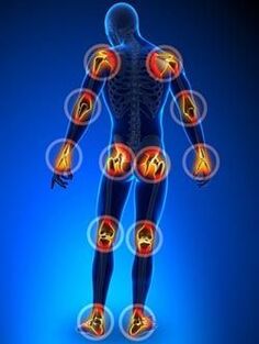 Ubicación de las articulaciones afectadas por la osteoartritis