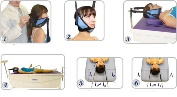 tratamiento de la osteocondrosis cervical por tracción